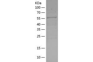 Western Blotting (WB) image for Protein Kinase, AMP-Activated, beta 2 Non-Catalytic Subunit (PRKAB2) (AA 1-272) protein (His-IF2DI Tag) (ABIN7124660)