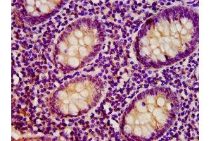 IHC image of ABIN7172046 diluted at 1:400 and staining in paraffin-embedded human appendix tissue performed on a Leica BondTM system. (TST 抗体  (AA 2-297))