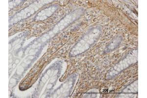 Immunoperoxidase of purified MaxPab antibody to CALD1 on formalin-fixed paraffin-embedded human small Intestine. (Caldesmon 抗体  (AA 1-538))