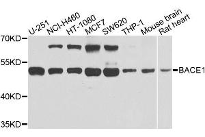 Western blot analysis of extracts of various cell lines, using BACE1 antibody. (BACE1 抗体  (AA 22-322))