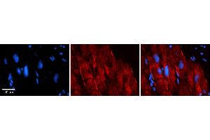 Rabbit Anti-AKAP7 Antibody    Formalin Fixed Paraffin Embedded Tissue: Human Adult heart  Observed Staining: Membrane, Cytoplasmic Primary Antibody Concentration: 1:600 Secondary Antibody: Donkey anti-Rabbit-Cy2/3 Secondary Antibody Concentration: 1:200 Magnification: 20X Exposure Time: 0. (AKAP7 抗体  (Middle Region))