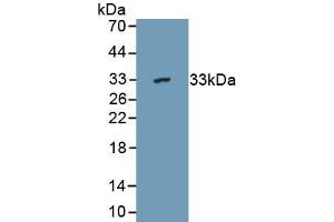 Detection of Recombinant DARS2, Mouse using Polyclonal Antibody to Aspartyl tRNA Synthetase 2, Mitochondrial (DARS2)