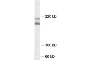 dilution: 1 : 1000, sample: rat hippocampus homogenate (SHANK2 抗体  (AA 1042-1475))