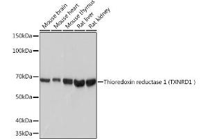 Western blot analysis of extracts of various cell lines, using Thioredoxin reductase 1 (Thioredoxin reductase 1 (TXNRD1 ) ) Rabbit mAb (ABIN7270805) at 1:1000 dilution. (TXNRD1 抗体)