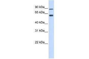 WB Suggested Anti-EFEMP1 Antibody Titration:  0. (FBLN3 抗体  (Middle Region))