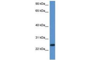 Image no. 1 for anti-Chromosome 1 Open Reading Frame 93 (C1orf93) (AA 96-145) antibody (ABIN6747236) (C1orf93 抗体  (AA 96-145))