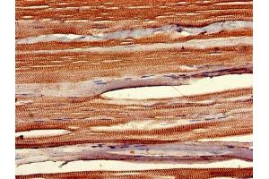 IHC image of ABIN7155848 diluted at 1:400 and staining in paraffin-embedded human skeletal muscle tissue performed on a Leica BondTM system. (SIX Homeobox 1 抗体  (AA 144-262))