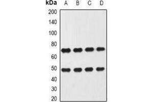 Western blot analysis of Heparanase expression in Hela (A), MCF7 (B), mouse liver (C), mouse lung (D) whole cell lysates. (HPSE 抗体)