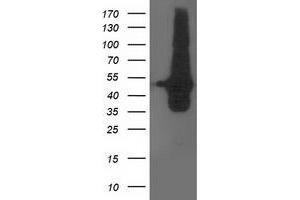 HEK293T cells were transfected with the pCMV6-ENTRY control (Left lane) or pCMV6-ENTRY DOK2 (Right lane) cDNA for 48 hrs and lysed. (DOK2 抗体)