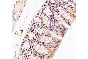 Immunohistochemistry of paraffin embedded mouse colon using DMRTA2 (ABIN7073753) at dilution of 1: 700 (400x lens) (DMRTA2 抗体)