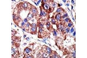 Immunohistochemistry (IHC) image for anti-Sequestosome 1 (SQSTM1) (AA 317-346) antibody (ABIN3031543)