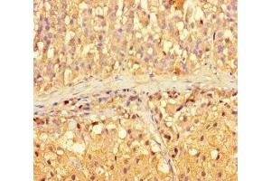 Immunohistochemistry of paraffin-embedded human adrenal gland tissue using ABIN7143489 at dilution of 1:100 (ARL16 抗体  (AA 1-197))
