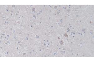 Detection of JAM2 in Human Cerebrum Tissue using Polyclonal Antibody to Junctional Adhesion Molecule 2 (JAM2) (JAM2 抗体  (AA 74-250))