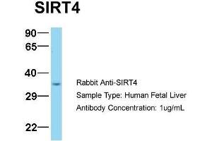 Host:  Rabbit  Target Name:  SIRT4  Sample Type:  Human Fetal Liver  Antibody Dilution:  1. (SIRT4 抗体  (N-Term))