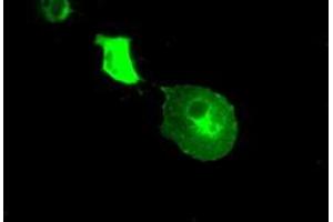 Image no. 4 for anti-Crystallin, alpha B (CRYAB) antibody (ABIN1497641) (CRYAB 抗体)