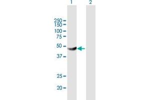 Western Blot analysis of HKDC1 expression in transfected 293T cell line by HKDC1 MaxPab polyclonal antibody. (HKDC1 抗体  (AA 1-427))