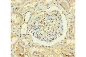 Immunohistochemistry of paraffin-embedded human kidney tissue using ABIN7173277 at dilution of 1:100 (TMEM82 抗体  (AA 168-202))