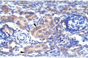 Immunohistochemical staining (Formalin-fixed paraffin-embedded sections) of human kidney with KCNAB3 polyclonal antibody  at 4-8 ug/mL working concentration. (KCNAB3 抗体  (N-Term))