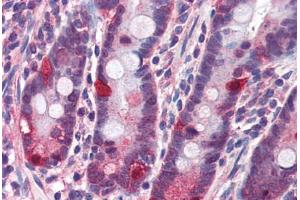 Human Small Intestine (formalin-fixed, paraffin-embedded) stained with NOD2 antibody ABIN351444 at 3 ug/ml followed by biotinylated goat anti-rabbit IgG secondary antibody ABIN481713, alkaline phosphatase-streptavidin and chromogen. (NOD2 抗体  (C-Term))