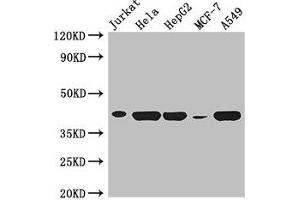 Western Blot Positive WB detected in: Jurkat whole cell lysate, Hela whole cell lysate, HepG2 whole cell lysate, MCF-7 whole cell lysate, A549 whole cell lysate All lanes: HLA-B antibody at 3 μg/mL Secondary Goat polyclonal to rabbit IgG at 1/50000 dilution Predicted band size: 41 kDa Observed band size: 41 kDa (HLA-B 抗体  (AA 25-308))
