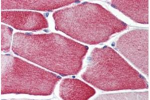 Human Skeletal Muscle: Formalin-Fixed, Paraffin-Embedded (FFPE) (CASQ2 抗体  (AA 20-400))
