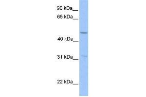 Human HepG2; WB Suggested Anti-ZNF342 Antibody Titration: 0. (Zinc Finger Protein 296 (ZNF296) (Middle Region) 抗体)