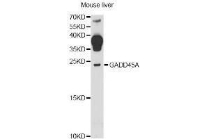 Western blot analysis of extracts of mouse liver, using GADD45A antibody (ABIN6292100) at 1:1000 dilution. (GADD45A 抗体)