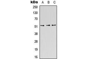 Western blot analysis of CD218b expression in HEK293T (A), Raw264. (IL18RAP 抗体  (Center))