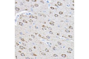 Immunohistochemistry (IHC) image for anti-Protein Tyrosine Phosphatase, Non Receptor Type 23 (PTPN23) (AA 1230-1450) antibody (ABIN1682396)