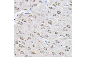 Immunohistochemistry of paraffin-embedded rat brain using PTPN23 Rabbit pAb (ABIN1682396, ABIN3019081, ABIN3019082 and ABIN6220704) at dilution of 1:100 (40x lens). (PTPN23 抗体  (AA 1230-1450))