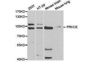 Western Blotting (WB) image for anti-Protein Kinase C, epsilon (PRKCE) antibody (ABIN1874300) (PKC epsilon 抗体)