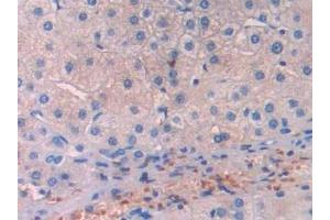 Immunohistochemistry (IHC) image for anti-Lecithin-Cholesterol Acyltransferase (LCAT) (AA 290-433) antibody (ABIN7436690)
