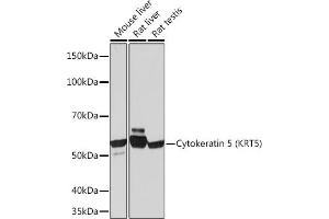 Western blot analysis of extracts of various cell lines, using Cytokeratin 5 (KRT5) (KRT5) Rabbit mAb (ABIN7268103) at 1:1000 dilution. (Cytokeratin 5 抗体)