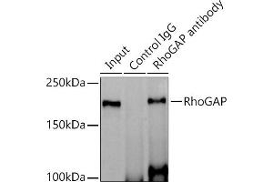 Immunoprecipitation analysis of 600 μg extracts of Mouse brain cells using 3 μg RhoGAP antibody (ABIN1682830, ABIN3016006, ABIN3016007 and ABIN7101474). (ARHGAP5 抗体)