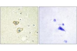 Immunohistochemistry analysis of paraffin-embedded human brain tissue, using EGFR (Ab-1016) Antibody. (EGFR 抗体  (AA 986-1035))