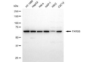 anti-Phenylalanyl-tRNA Synthetase, beta Subunit (FARSB) antibody