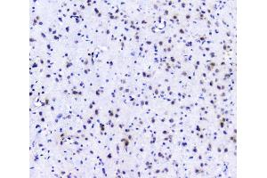 IHC analysis of POLR2A using anti-POLR2A antibody (ABIN7599598). (POLR2A/RPB1 抗体  (AA 10-321))