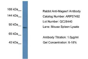 Western Blotting (WB) image for anti-Melanoma Antigen Family E, 1 (MAGEE1) (C-Term) antibody (ABIN785900) (MAGEE1 抗体  (C-Term))