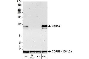 Western Blotting (WB) image for anti-B-Cell CLL/lymphoma 11A (Zinc Finger Protein) (BCL11A) (AA 1-50) antibody (ABIN7453321) (Recombinant BCL11A 抗体  (AA 1-50))