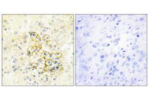 Immunohistochemistry (IHC) image for anti-Prostate Transmembrane Protein, Androgen Induced 1 (PMEPA1) (Internal Region) antibody (ABIN1849883) (PMEPA1 抗体  (Internal Region))