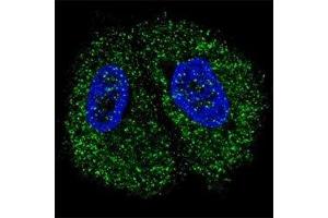 Fluorescent confocal image of MCF7 cells stained with PKM2 antibody. (PKM2 抗体  (AA 476-505))