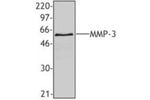 Image no. 1 for anti-Matrix Metallopeptidase 3 (Stromelysin 1, Progelatinase) (MMP3) antibody (ABIN205498) (MMP3 抗体)