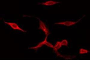 Immunofluorescence (fixed cells) (IF/ICC) image for anti-Prostaglandin E Receptor 4 (Subtype EP4) (PTGER4) (Internal Region) antibody (ABIN6259076)