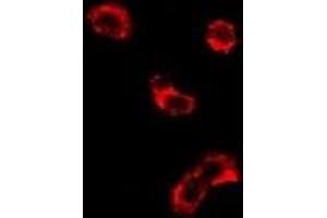 Immunofluorescent analysis of EEF1D staining in U2OS cells. (EEF1D 抗体)