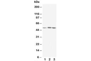 Western blot testing of NR1H3 antibody and Lane 1:  rat liver (NR1H3 抗体  (AA 375-398))