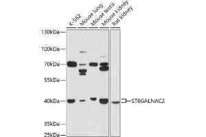 Western blot analysis of extracts of various cell lines, using ST6G antibody (ABIN7270579) at 1:1000 dilution. (ST6GALNAC2 抗体  (AA 30-200))