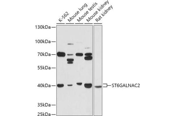ST6GALNAC2 Antikörper  (AA 30-200)