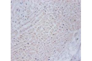 Immunohistochemistry of paraffin-embedded human umbilical cord tissue using ABIN7149009 at dilution of 1:100 (CSRP2 抗体  (AA 2-193))