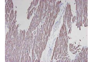 Image no. 4 for anti-Actin, alpha 1, Skeletal Muscle (ACTA1) antibody (ABIN1502284)