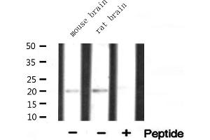 Western blot analysis of extracts of various tissue ,using RPL15 antibody (RPL15 抗体  (C-Term))